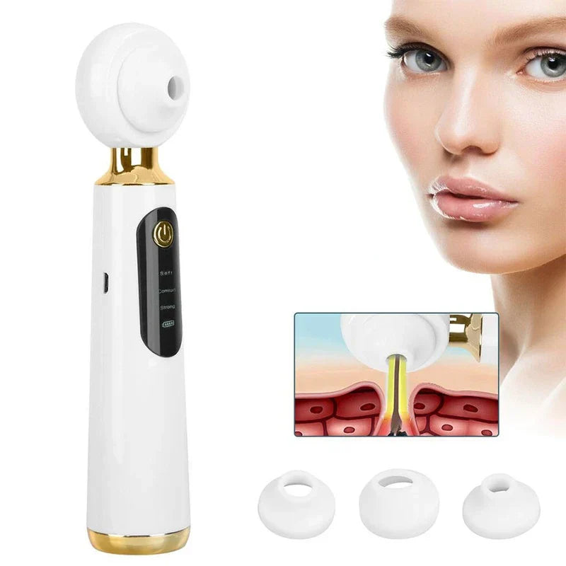 Visual Blackhead Remover Vacuum With Camera