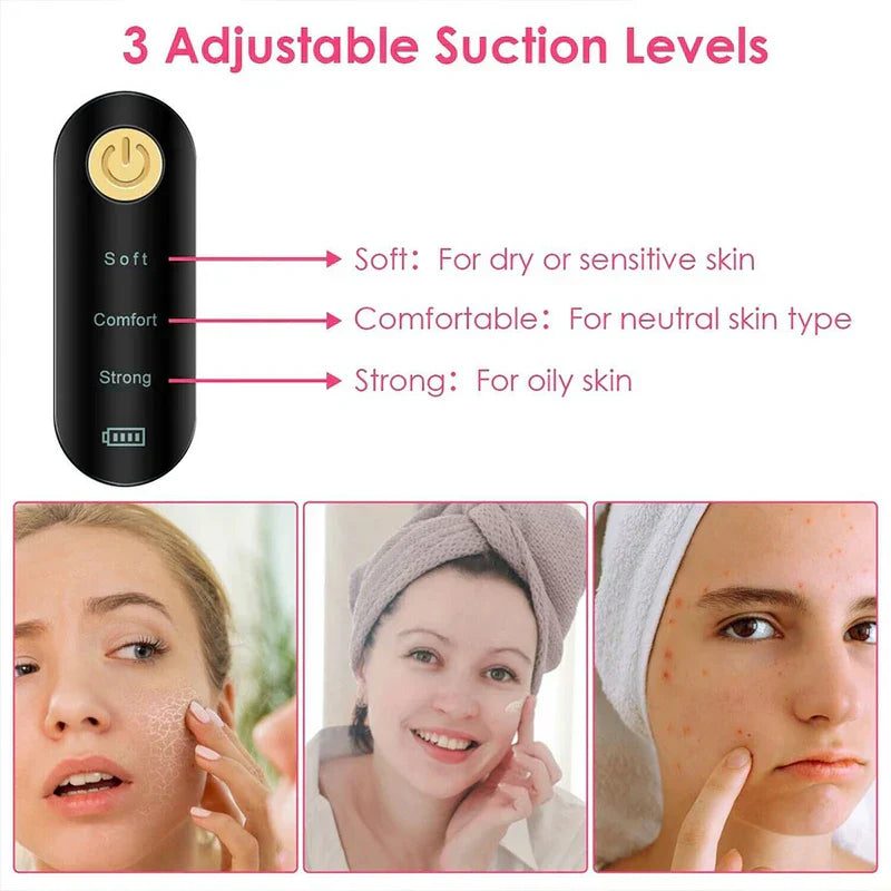 Visual Blackhead Remover Vacuum With Camera